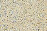 beige gestrahlt
